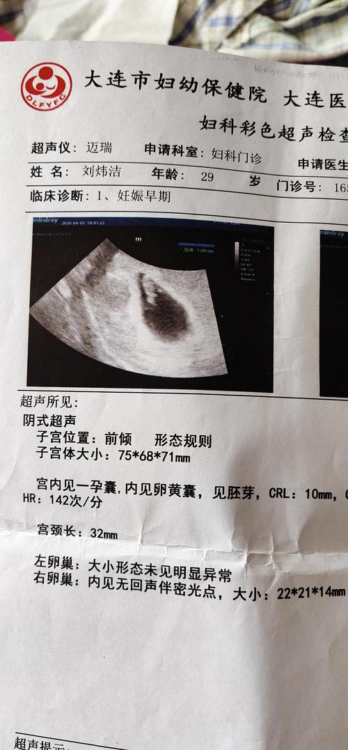 怀孕14周宝宝的位置图 怀孕14周胎儿图 4 伤感说说吧